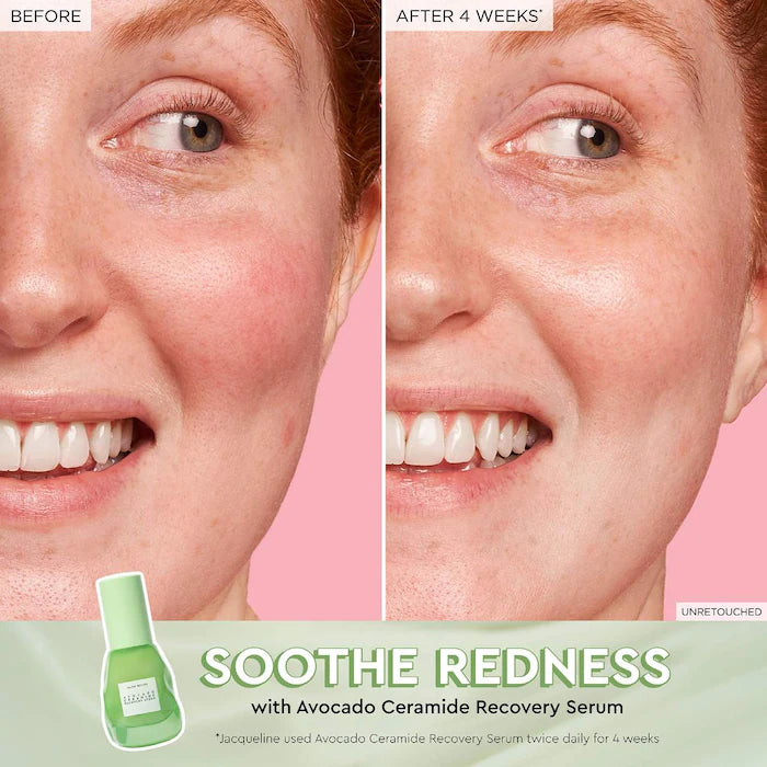 Avocado Soothing Skin Barrier Serum with Ceramides | PREVENTA
