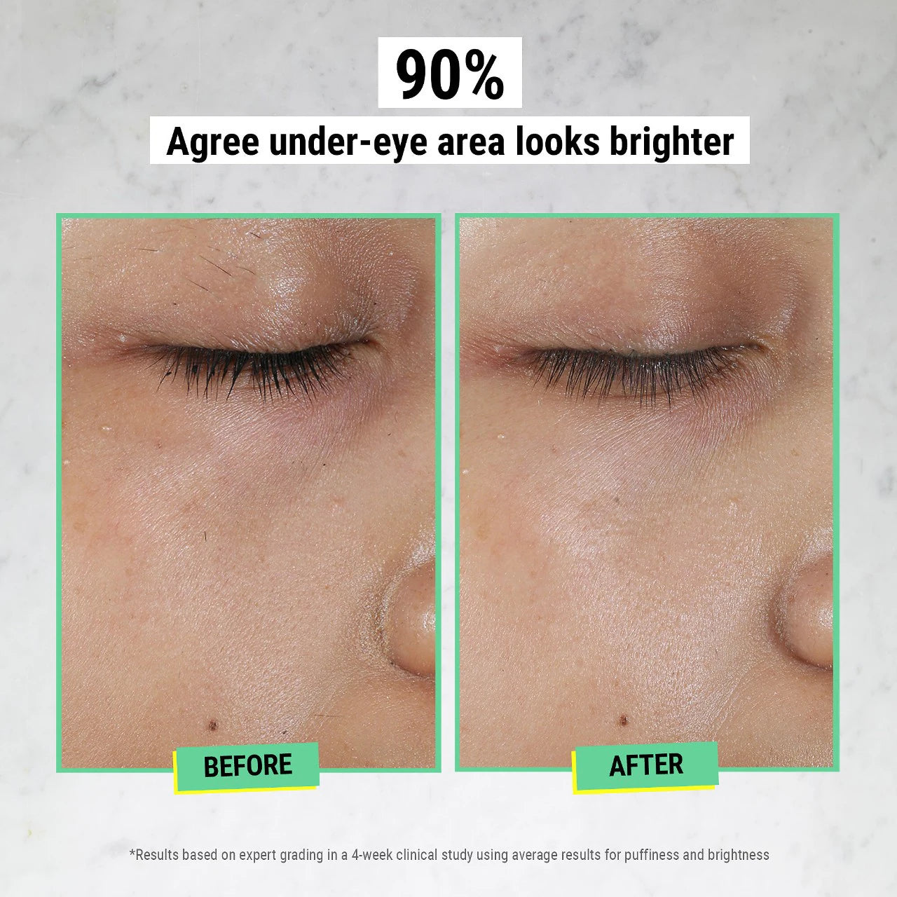 Hydrating Eye Treatment Cream With Avocado | PREVENTA