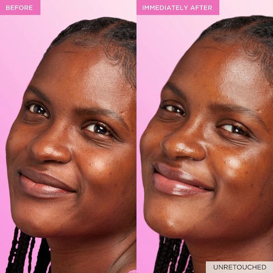 Watermelon Glow Niacinamide Dew Drops Serum | PREVENTA