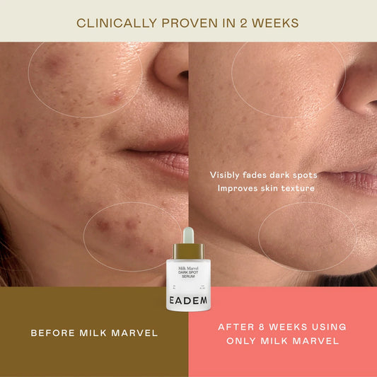 Milk Marvel Dark Spot Serum With Niacinamide & Vitamin C | PREVENTA