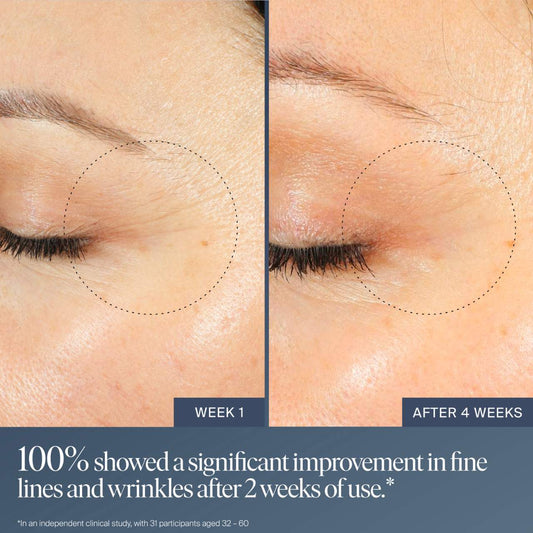 Jet Lag Overnight Eye Serum for Fine Lines & Wrinkles | PREVENTA