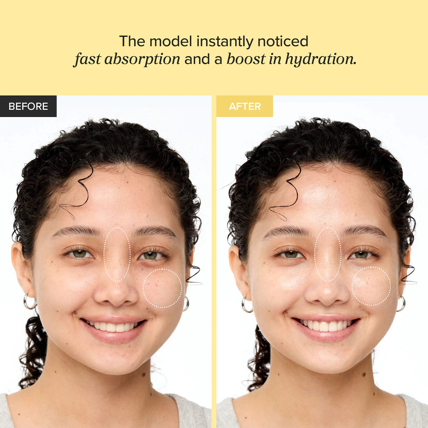 Glow Serum for Oil Control with Niacinamide | PREVENTA