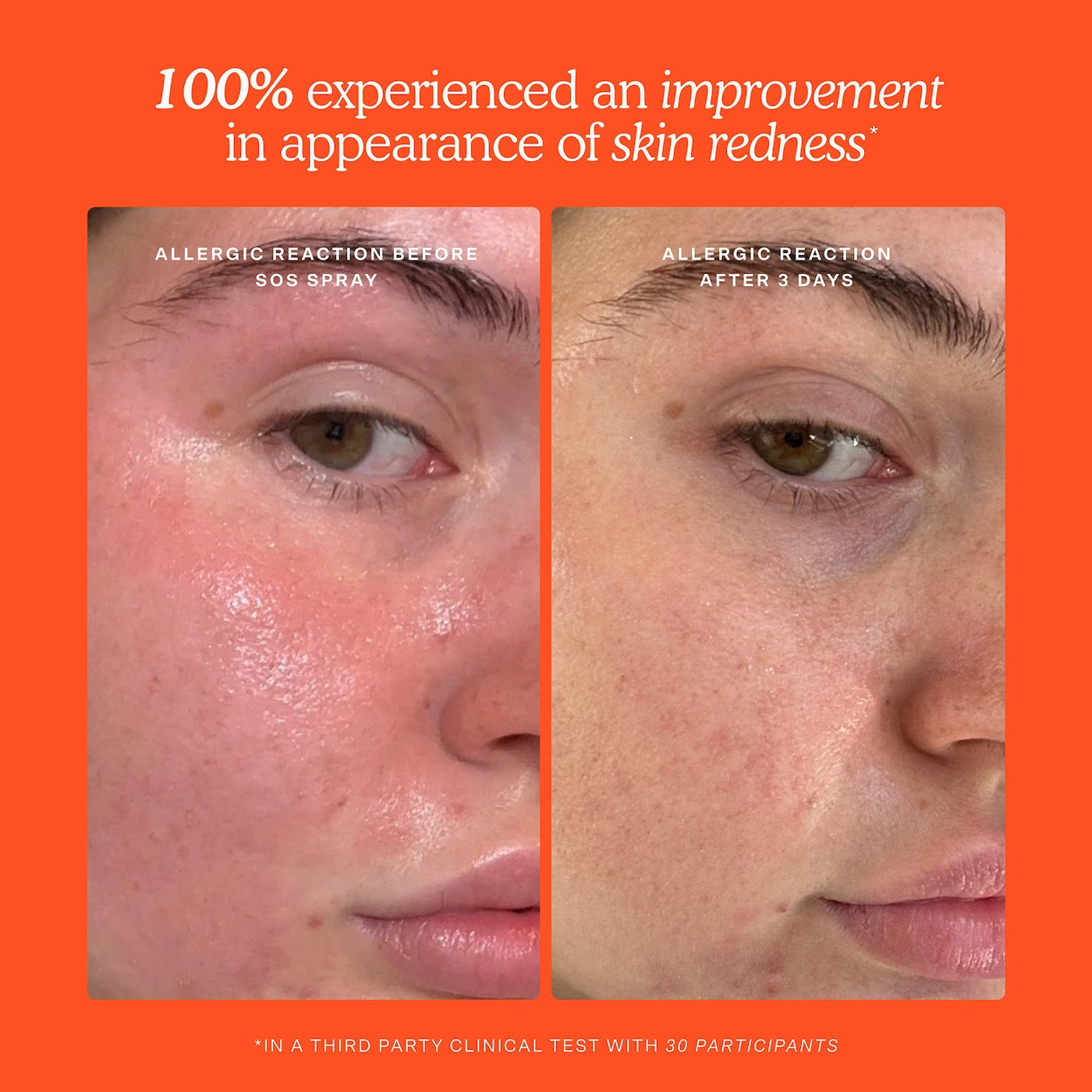 Mini SOS Skincare Bestsellers Set | PREVENTA