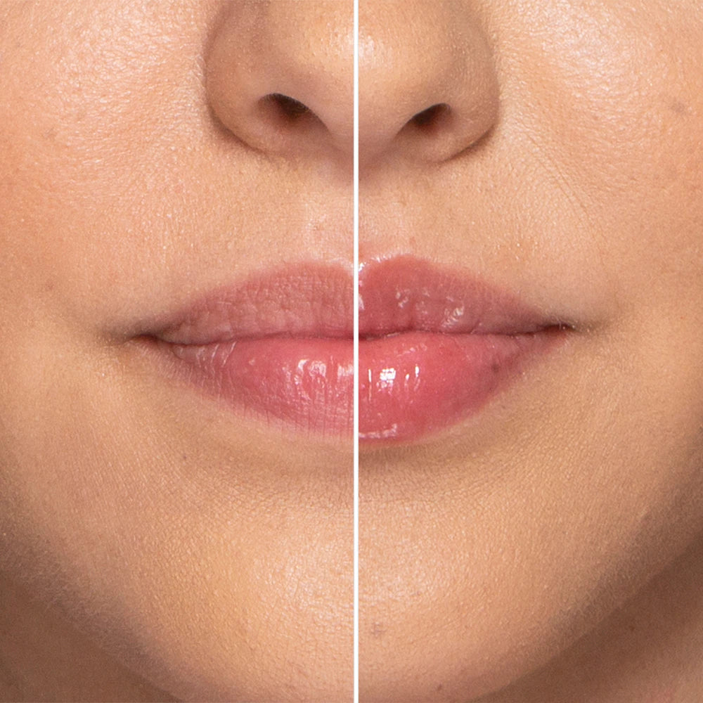 Lip Injection Extreme Lip Plumper