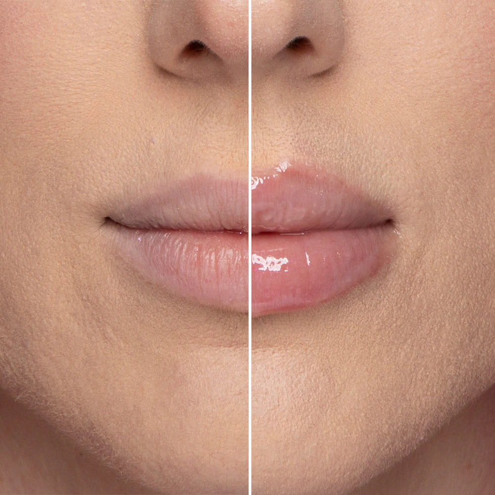 Lip Injection Extreme Lip Plumper
