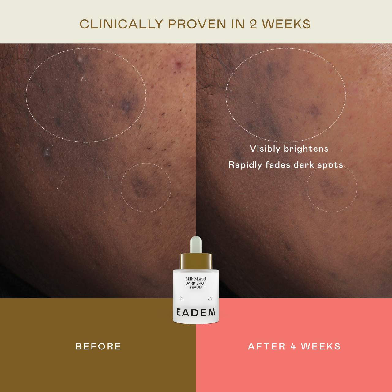 Milk Marvel Dark Spot Serum With Niacinamide & Vitamin C | PREVENTA