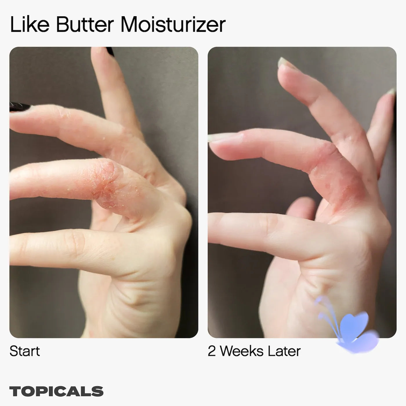 Like Butter Moisturizer for Dry, Sensitive & Eczema-Prone Skin | PREVENTA