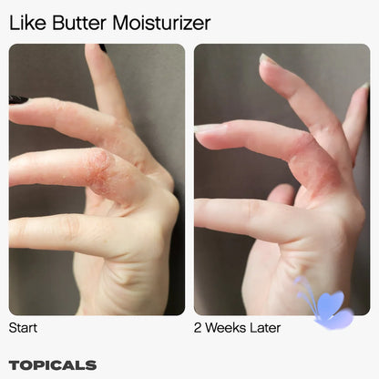Like Butter Moisturizer for Dry, Sensitive & Eczema-Prone Skin | PREVENTA