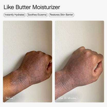 Like Butter Moisturizer for Dry, Sensitive & Eczema-Prone Skin | PREVENTA