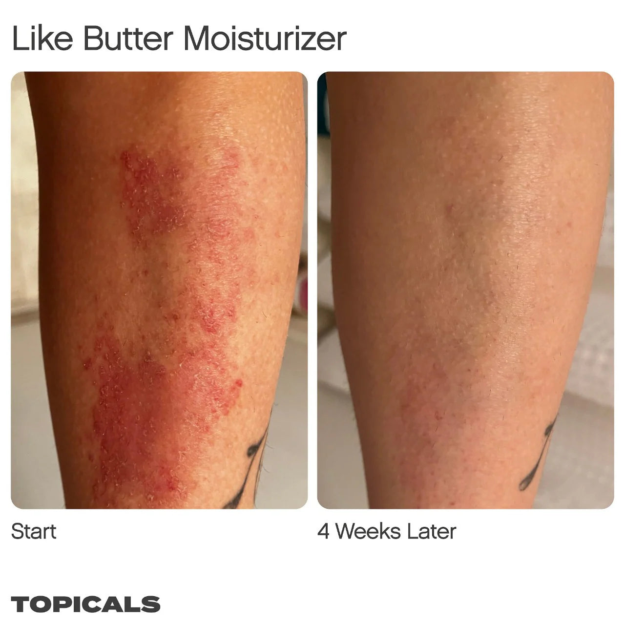 Like Butter Moisturizer for Dry, Sensitive & Eczema-Prone Skin | PREVENTA