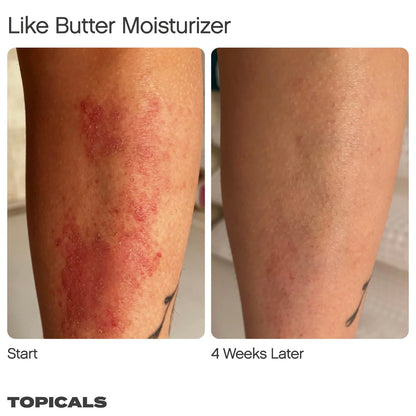 Like Butter Moisturizer for Dry, Sensitive & Eczema-Prone Skin | PREVENTA