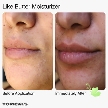 Like Butter Moisturizer for Dry, Sensitive & Eczema-Prone Skin | PREVENTA