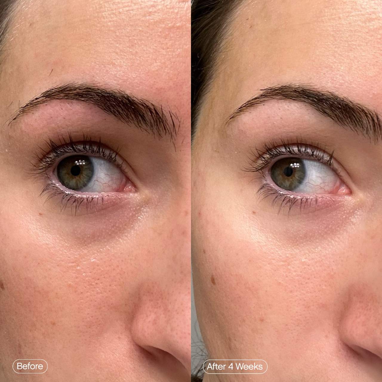 Faded Under Eye Brightening & Clearing Eye Masks | PREVENTA