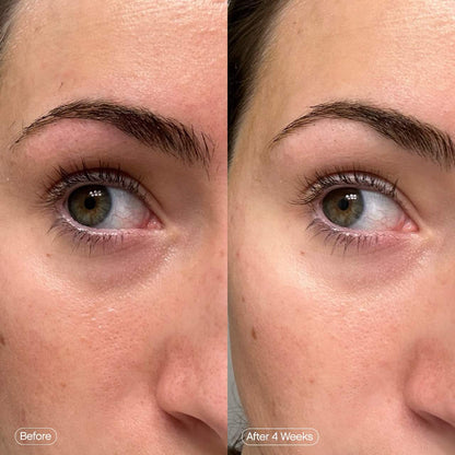 Faded Under Eye Brightening & Clearing Eye Masks | PREVENTA