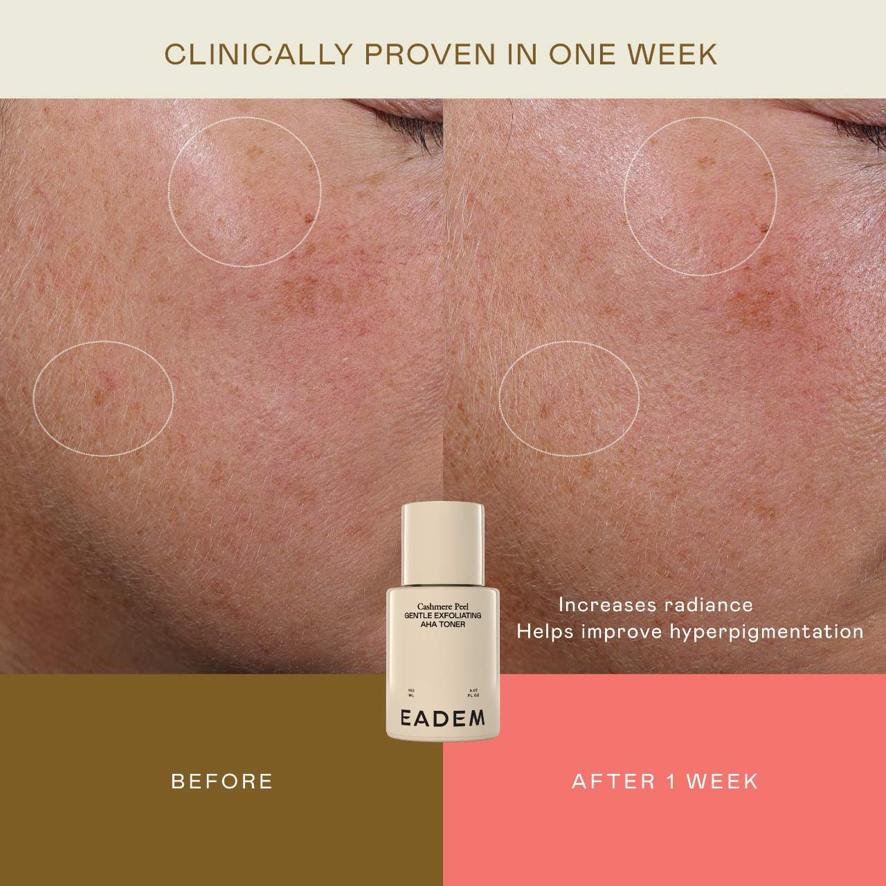 Cashmere Peel Milky Exfoliant & Hydrating Essence | PREVENTA