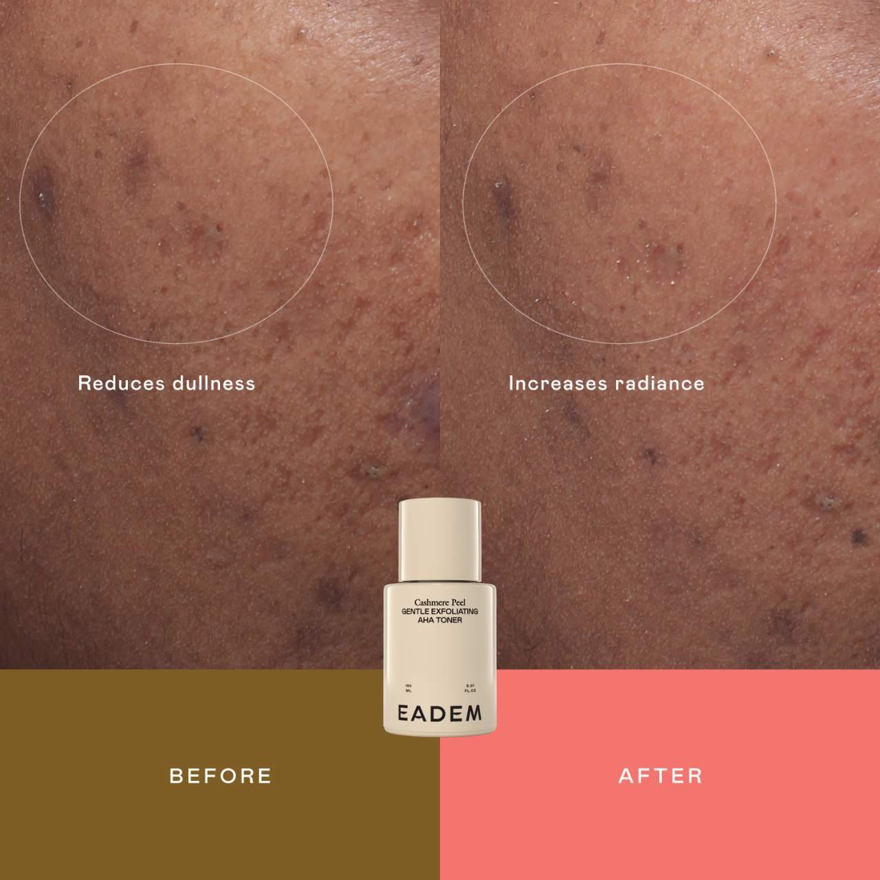 Cashmere Peel Milky Exfoliant & Hydrating Essence | PREVENTA
