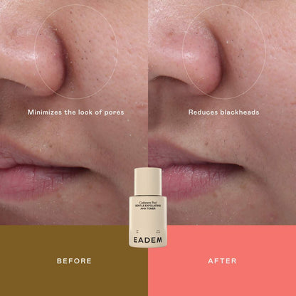 Cashmere Peel Milky Exfoliant & Hydrating Essence | PREVENTA