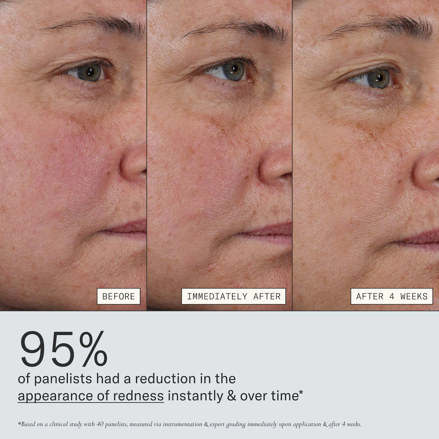 Deliverance 3-in-1 Repair Serum for Redness, Wrinkles, Dark Spots | PREVENTA