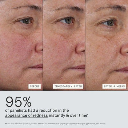 Deliverance 3-in-1 Repair Serum for Redness, Wrinkles, Dark Spots | PREVENTA