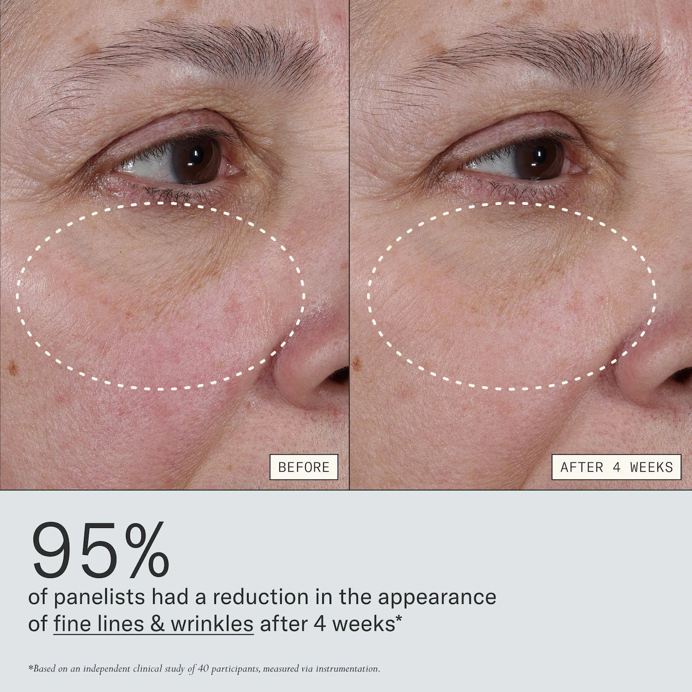 Deliverance 3-in-1 Repair Serum for Redness, Wrinkles, Dark Spots | PREVENTA