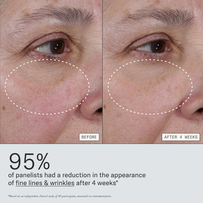 Deliverance 3-in-1 Repair Serum for Redness, Wrinkles, Dark Spots | PREVENTA