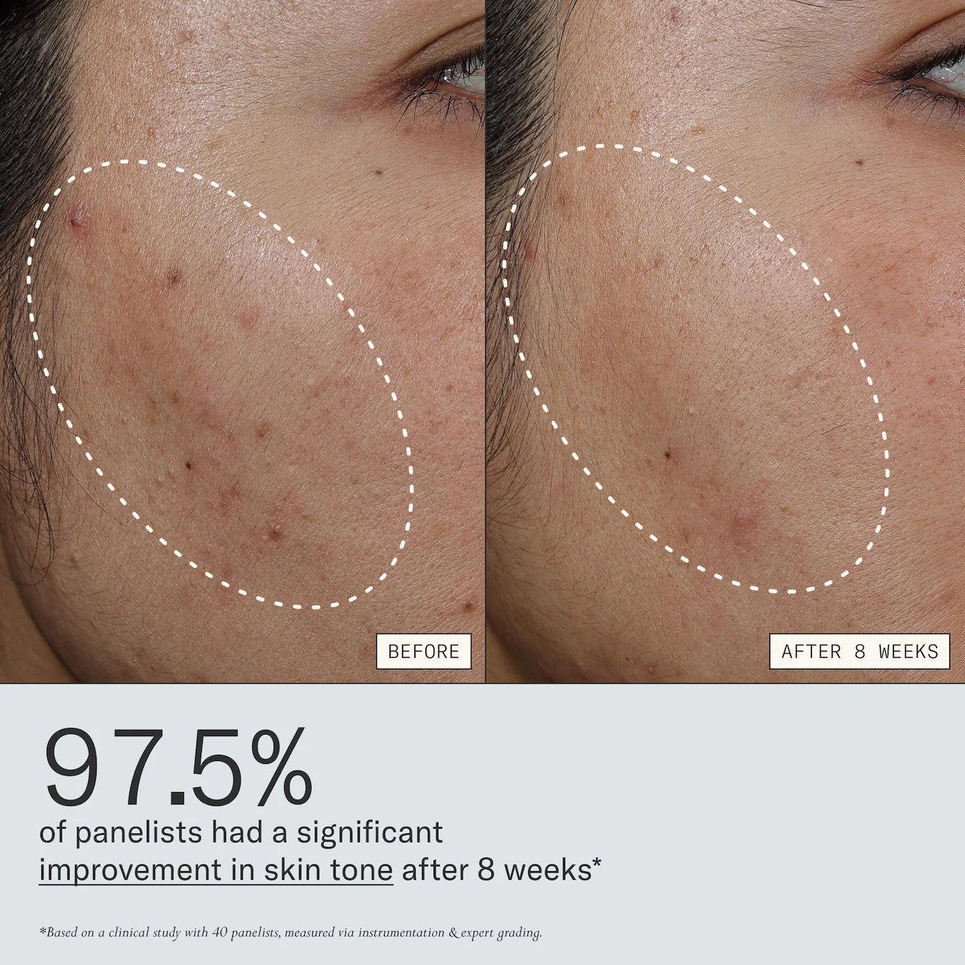 Deliverance 3-in-1 Repair Serum for Redness, Wrinkles, Dark Spots | PREVENTA