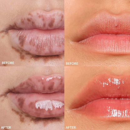 Mini Lip Gloss Set | PREVENTA