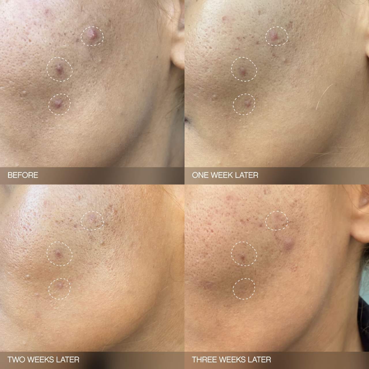 Faded Brightening Bundle for Discoloration on Face & Body | PREVENTA
