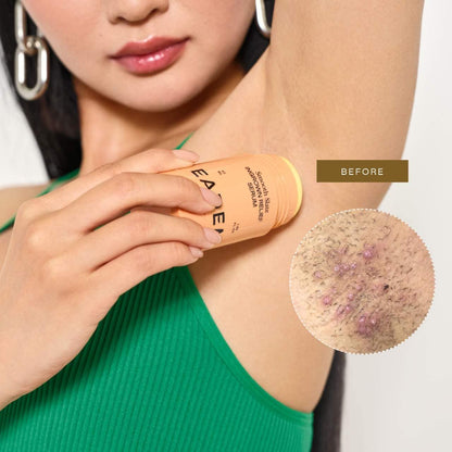 Smooth Slate Ingrown Hair + Dark Spot Serum With AHAs, Azelaic Acid for Body & Face | PREVENTA