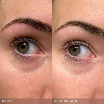 Faded Brightening Bundle for Discoloration on Face & Body | PREVENTA