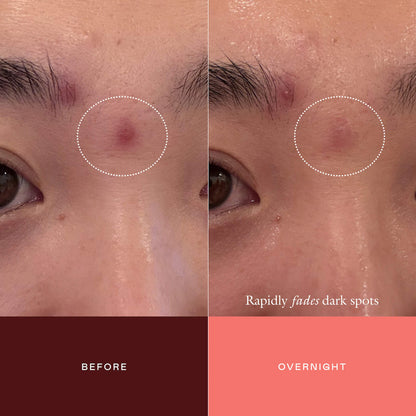 The Mark Advanced Targeted Dark Spot Concentrate | PREVENTA