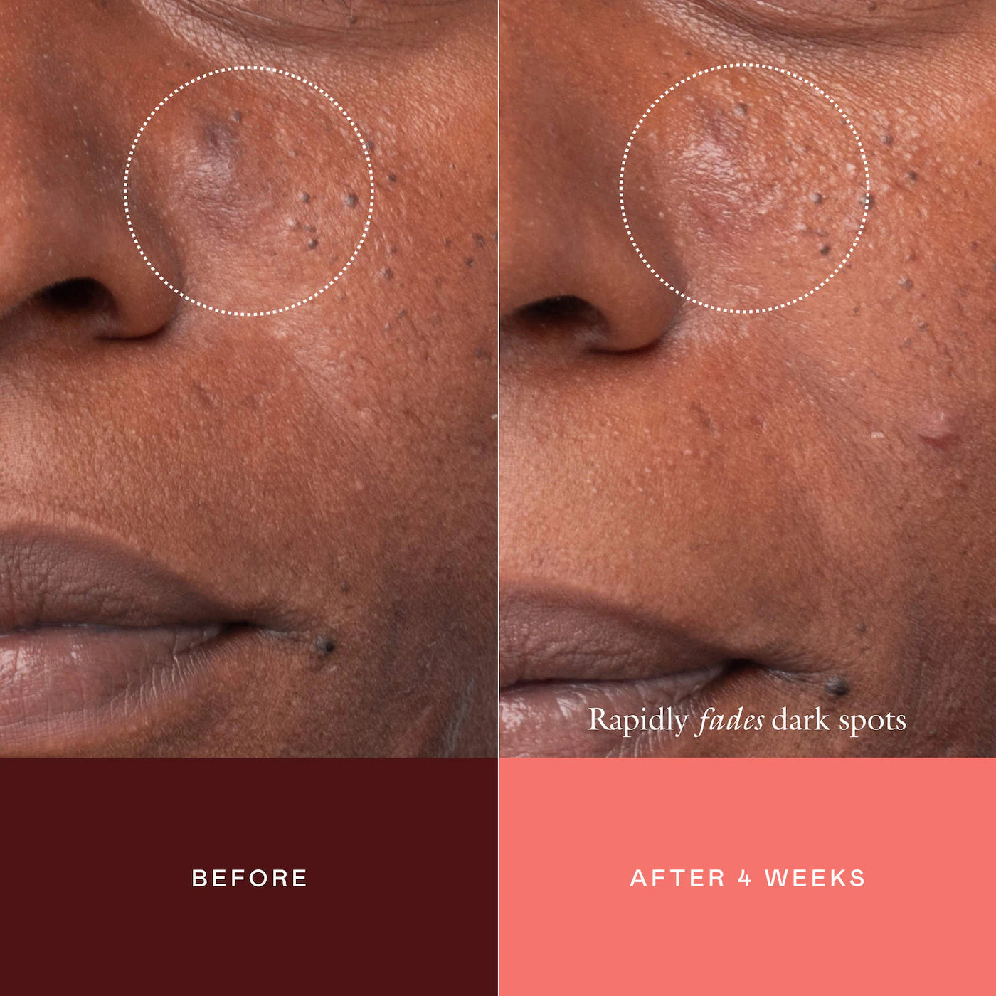 The Mark Advanced Targeted Dark Spot Concentrate | PREVENTA