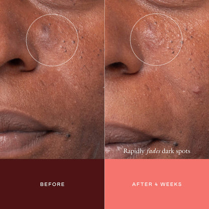 The Mark Advanced Targeted Dark Spot Concentrate | PREVENTA