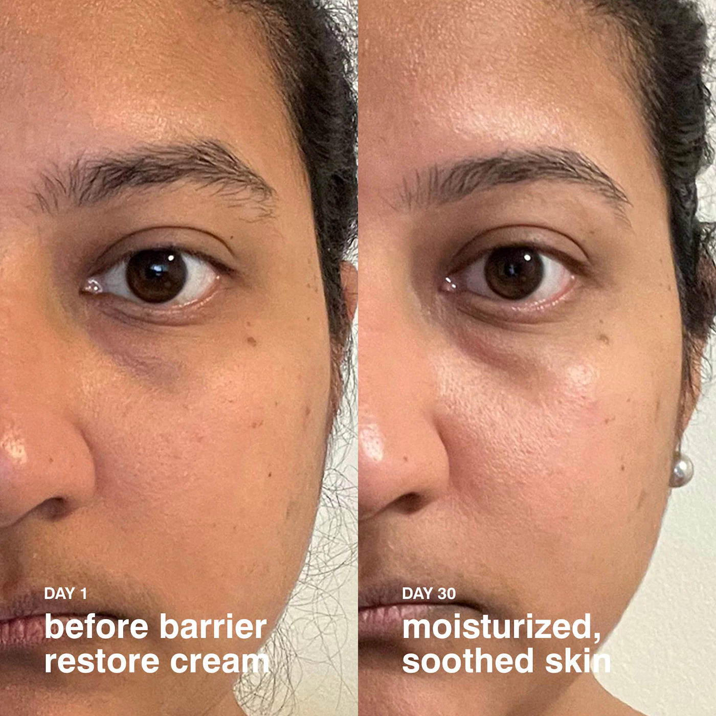 Barrier Restore Cream Comforting Daily Moisturizer | PREVENTA