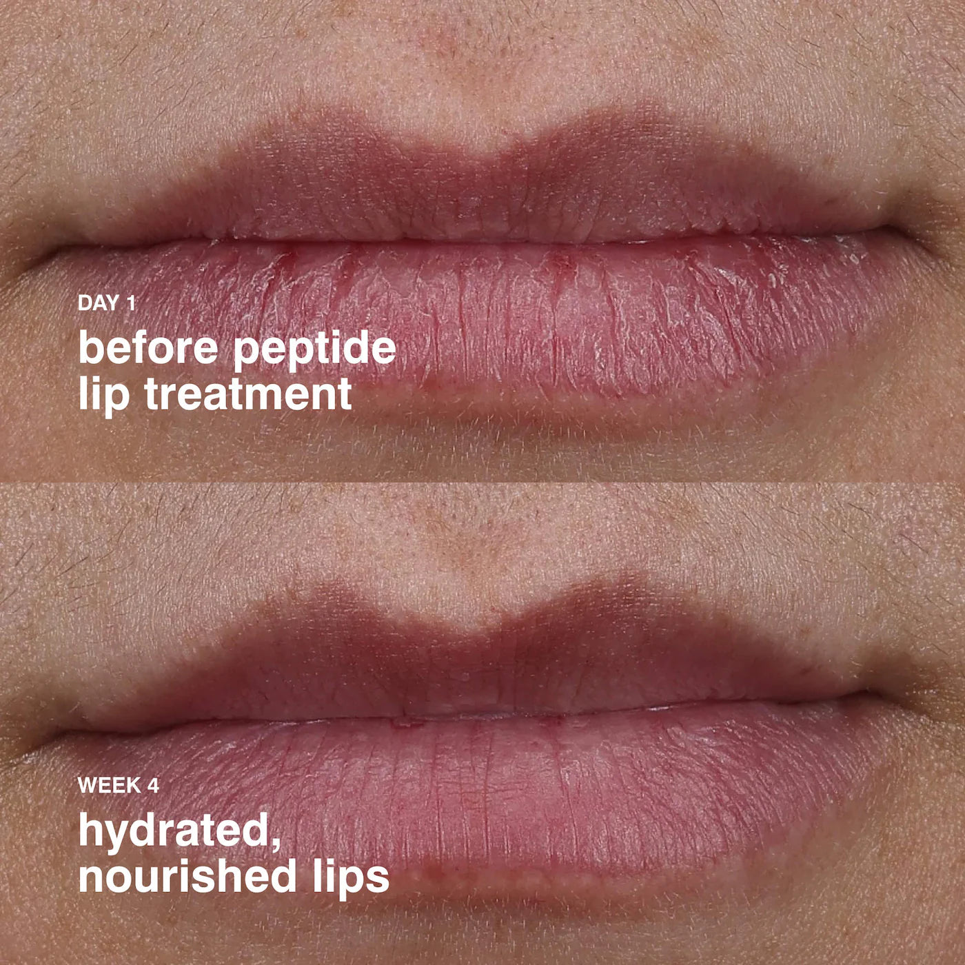 Peptide Lip Treatment Nourishing Glaze | PREVENTA
