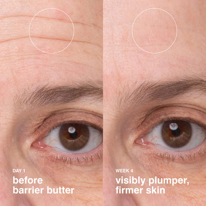 Barrier Butter Intensive Moisture Balm | PREVENTA