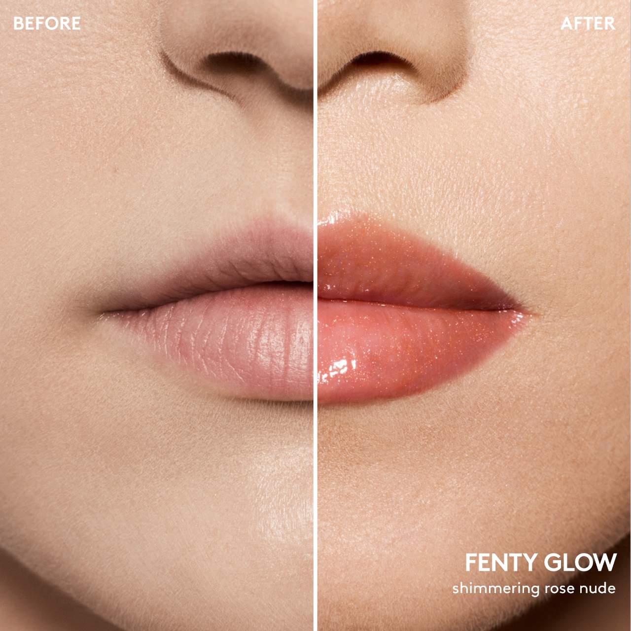 Lip Value Set | PREVENTA