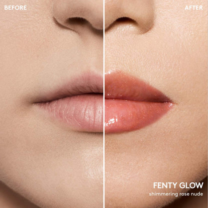 Lip Value Set | PREVENTA