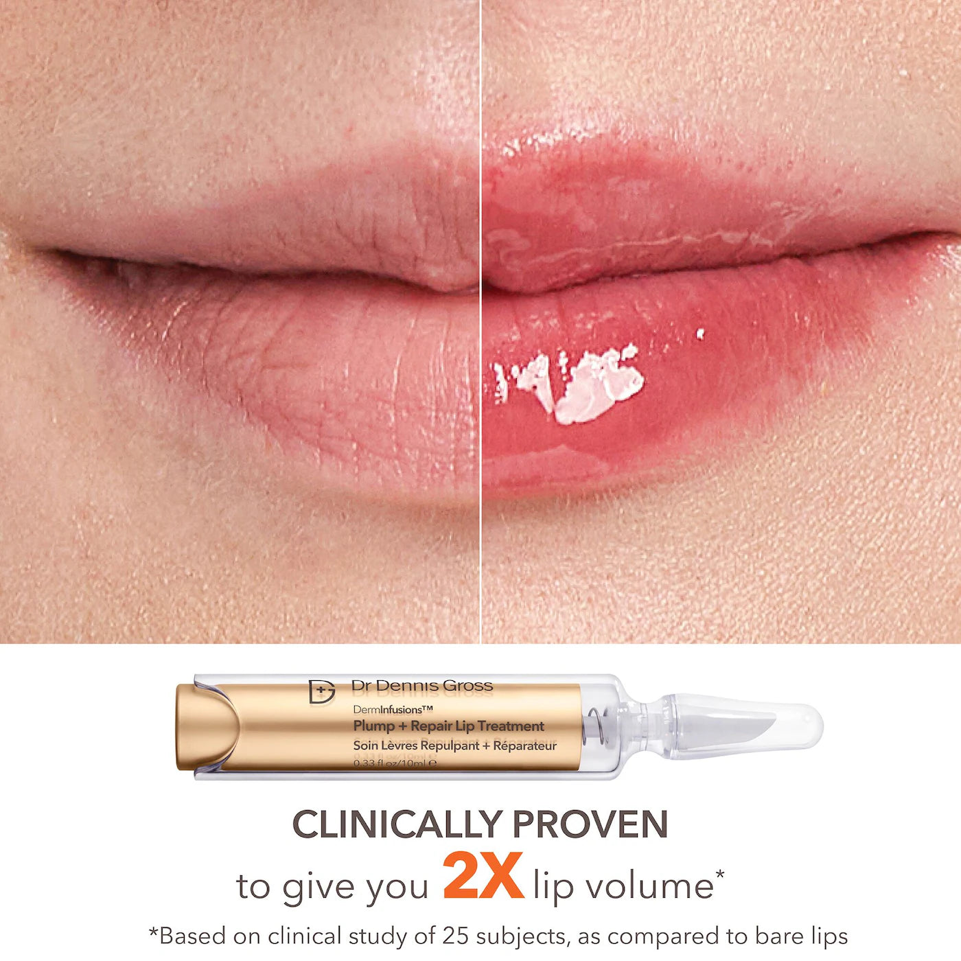 Lip Value Set | PREVENTA