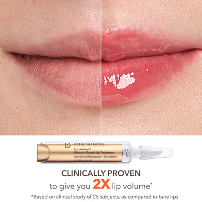 Lip Value Set | PREVENTA