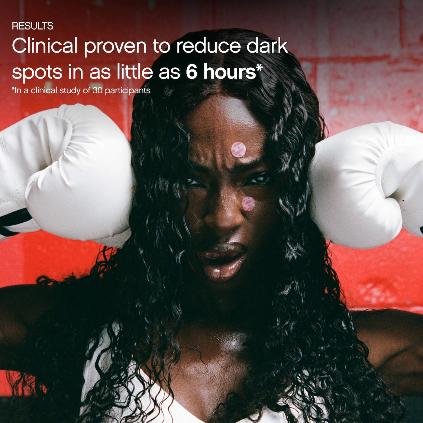 Faded Tranexamic Acid Dark Spot Patches for Hyperpigmentation | PREVENTA