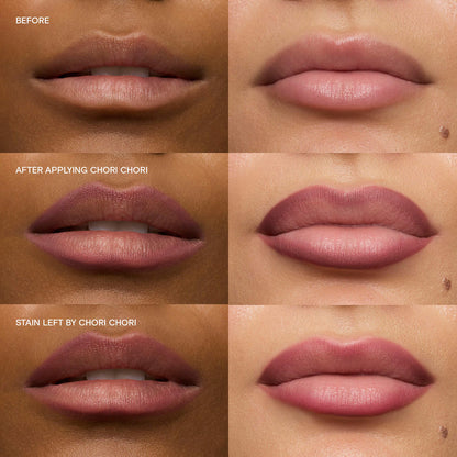 Lip Kit Value Set | PREVENTA
