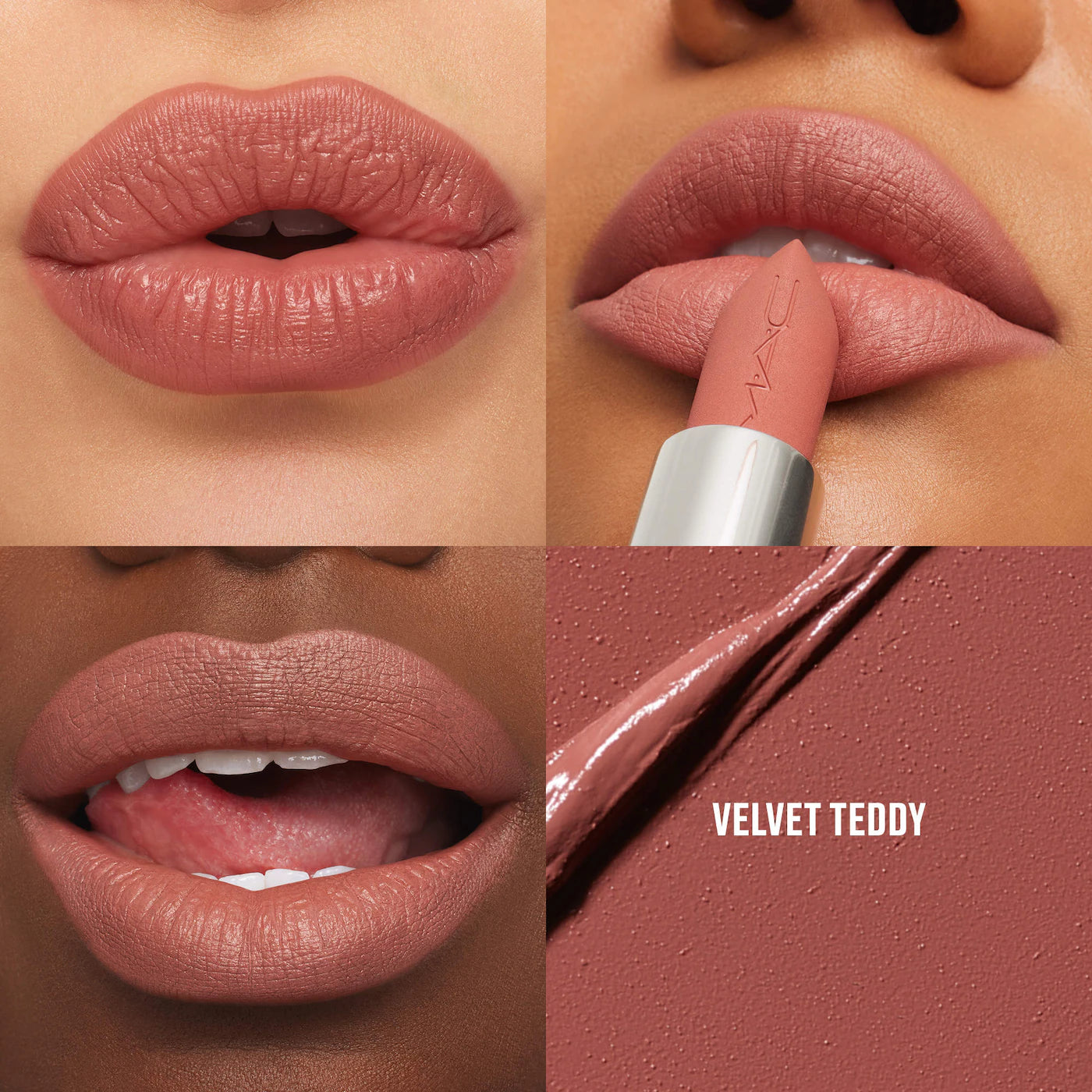 Lip Kit Value Set | PREVENTA