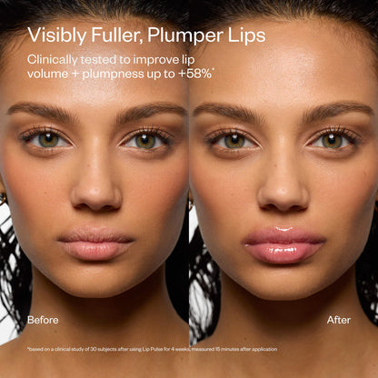 Mini Lip Pulse Lip Plumper Gift Set | PREVENTA